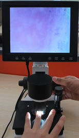 Покрасьте пикселы микроскопа 380000 капилляра оборудования микроциркуляции Nailfold с CE